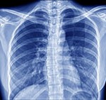 General X-Ray