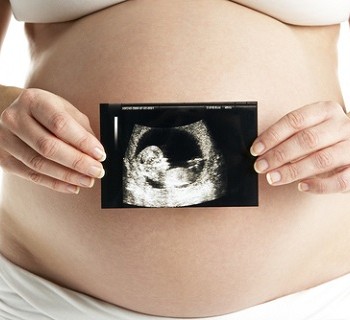 Obstetrical Ultrasounds